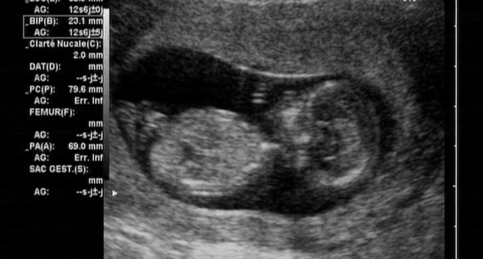 Texas Girl Sues Parents Trying To Force Abortion